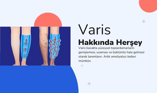 Varisler Hakkında