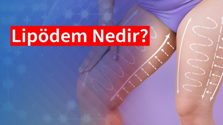 Lipödem nedir