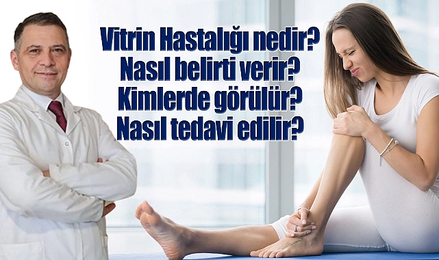 Vitrin hastalığı nedir? Belirtileri nelerdir? Kimlerde görülür? Nasıl tedavi edilir?